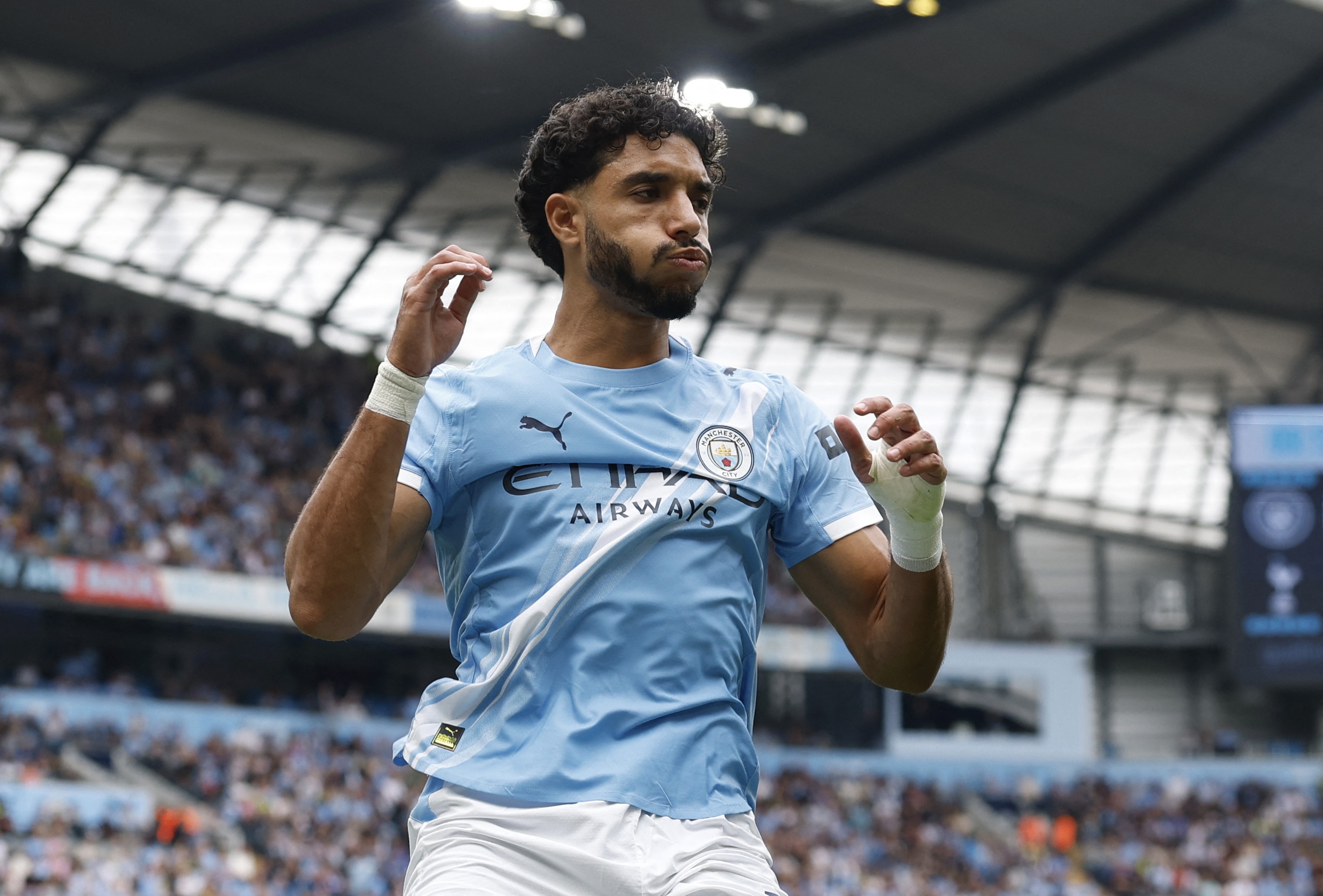 Khủng hoảng chấn thương ở derby Manchester